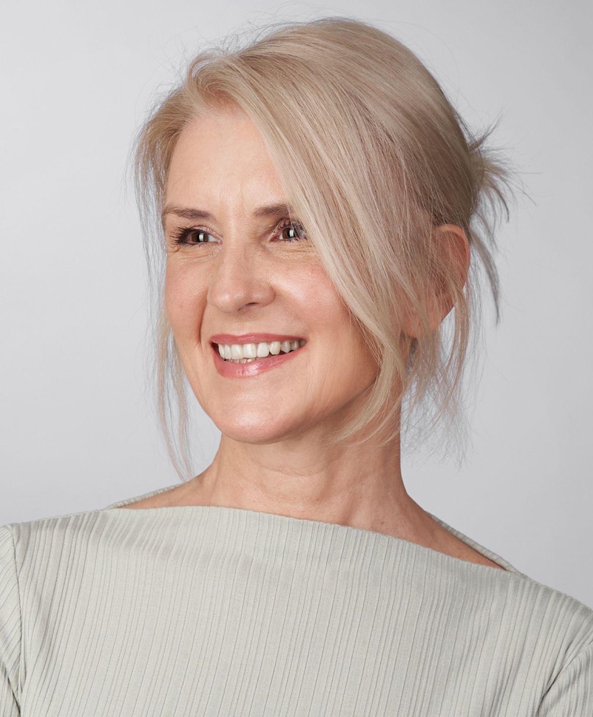 paramus dental implants model with blonde hair