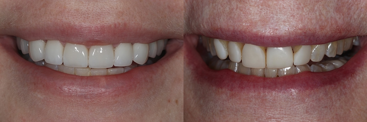 Before and after dental treatment comparison.